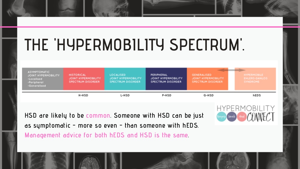 hypermobile-ehlersdanlos-syndrome-hypermobility-spectrum-disorders-a-presentation-4-1024.jpg